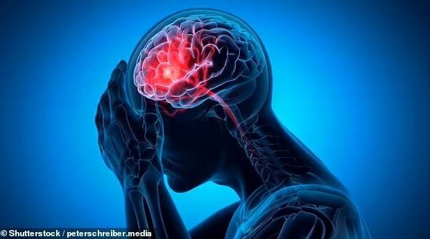 نشانه های مهم سکته مغزی را بشناسید